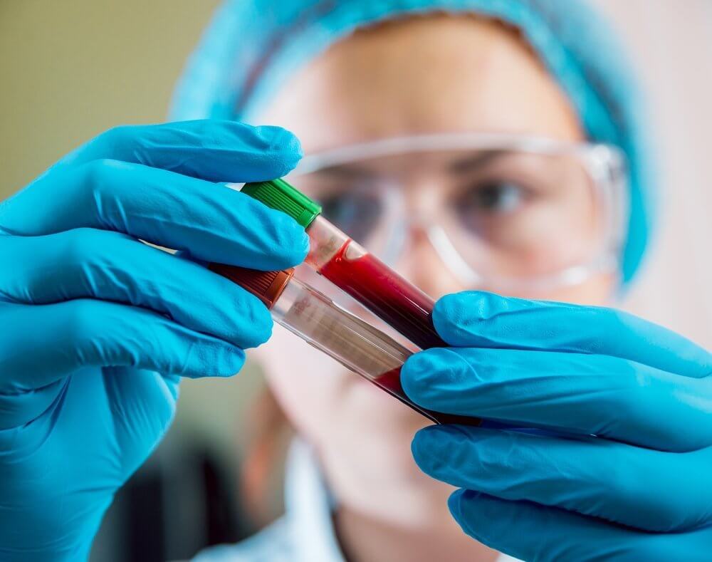 Где можно сдать анализ крови на гормоны в екатеринбурге thumbnail